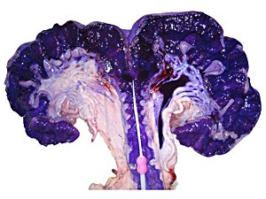 El tinte avanza hasta los cuernos de la unión de trompas uteral instantáneamente sin ningún perjuicio a la cerda.