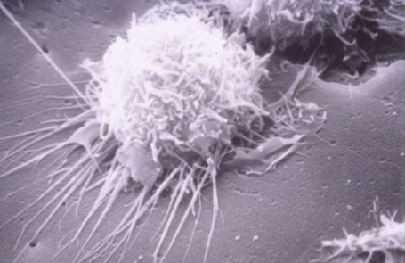 10 maneras de que los agentes patógenos se reparten 