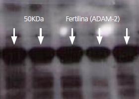 Identificacion por Western blot de la fertilina en Razas Porcinas