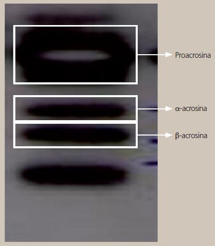 Identificacion por Western blot de la proacrosina en Razas Porcinas