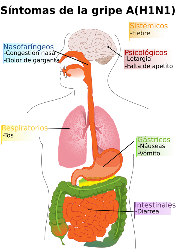 sintomas-de-la-gripe-a-h1n1-Razas-Porcinas