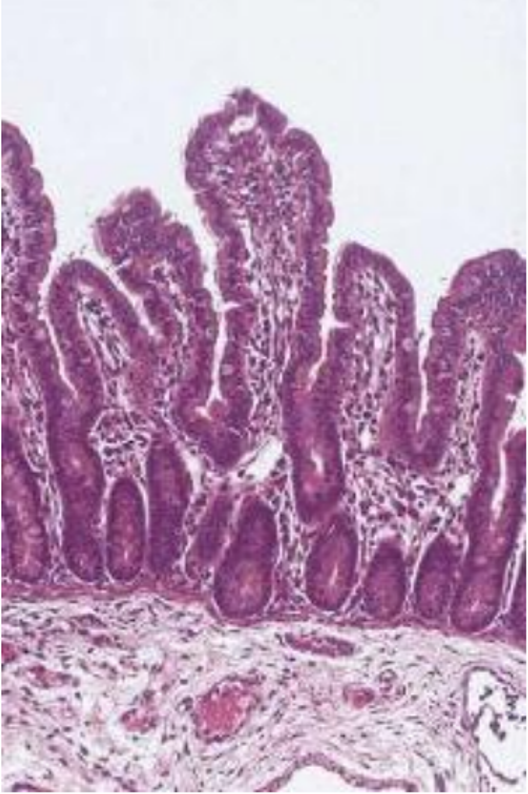 Diagnostico-de-necropsias-muestra-de-intestino-delgado-normal-que-corresponde-a-un-cerdo-recien-necropsiado-Razas-Porcinas