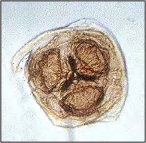 Vista-microscopica-de-los-parasitos-del-genero-ascaris-Razas-Porcinas