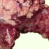 El futuro de la producción de carne a partir de células madres